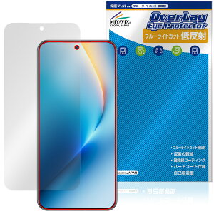 Honor Win RT �ی�t�B���� OverLay Eye Protector �ᔽ�� for �I�i�[ �X�}�[�g�t�H�� �t���ی� �u���[���C�g�J�b�g ���˖h�~