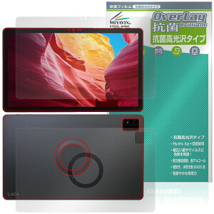 LUCA Tablet 14�C���` TM14D1M76-V1B �\ �w�� �ی�t�B���� OverLay �R�� Brilliant for �A�C���X�I�[���} ���J �^�u���b�g ������