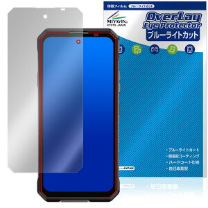 OUKITEL WP58 Pro �ی�t�B���� OverLay Eye Protector for �I�E�L�e�� �X�}�[�g�t�H�� �t���ی� �ڂɗD���� �u���[���C�g�J�b�g