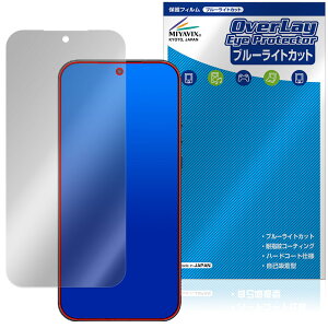 Xiaomi 17 Ultra by Leica �ی�t�B���� OverLay Eye Protector for �V���I�~�[ ���C�J �t���ی� �ڂɗD���� �u���[���C�g�J�b�g