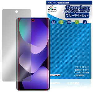 Xiaomi REDMI Note 15 5G �ی�t�B���� OverLay Eye Protector for �V���I�~�[ ���h�~ �m�[�g �t���ی� �ڂɗD���� �u���[���C�g�J�b�g