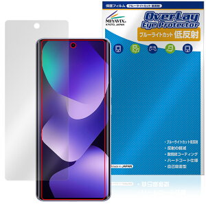 Xiaomi REDMI Note 15 5G �ی�t�B���� OverLay Eye Protector �ᔽ�� for �V���I�~�[ ���h�~ �m�[�g �u���[���C�g�J�b�g ���˖h�~