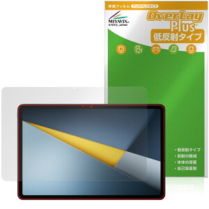 Xiaomi POCO Pad M1 �ی�t�B���� OverLay Plus for �V���I�~�[ �^�u���b�g �|�R �p�b�h �t���ی� �A���`�O���A ���˖h�~ ����� �w��h�~