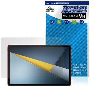 Xiaomi POCO Pad M1 �ی�t�B���� OverLay Eye Protector 9H for �V���I�~�[ �^�u���b�g �|�R �p�b�h �t���ی� ���d�x �u���[���C�g�J�b�g