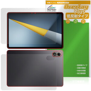 Xiaomi POCO Pad M1 �\�� �w�� �ی�t�B���� OverLay Plus for �V���I�~�[ �^�u���b�g �|�R �p�b�h �A���`�O���A ���˖h�~ �w��h�~