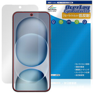 Honor Magic8 Pro Air �ی�t�B���� OverLay Eye Protector �ᔽ�� for �I�i�[ �}�W�b�N �t���ی� �u���[���C�g�J�b�g ���˖h�~