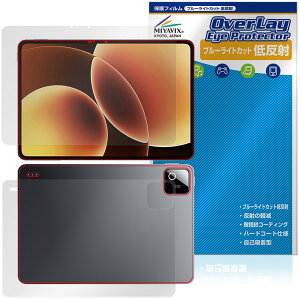 Xiaomi Pad 8 �\�� �w�� �ی�t�B���� OverLay Eye Protector �ᔽ�� for �V���I�~�[ �p�b�h �u���[���C�g�J�b�g ���˖h�~