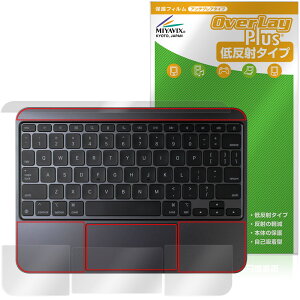 11�C���` iPad Pro M5 M4 �p�[�����X�g�E�g���b�N�p�b�h �ی�t�B���� OverLay Plus for �}�W�b�N�L�[�{�[�h �A���`�O���A �ᔽ�� �ώw��