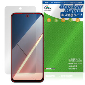 Xiaomi POCO M7 4G �ی�t�B���� OverLay Magic for �V���I�~�[ �|�R �X�}�[�g�t�H�� �t���ی� ���C�� �ώw�� �w��h�~ �R�[�e�B���O