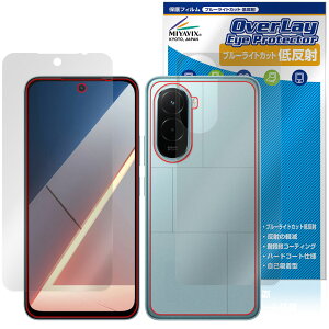 Xiaomi POCO M7 4G �\�� �w�� �ی�t�B���� OverLay Eye Protector �ᔽ�� for �V���I�~�[ �|�R �X�}�[�g�t�H�� �u���[���C�g�J�b�g