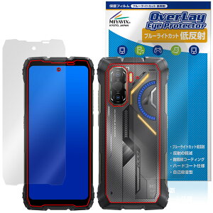 Blackview ROCK 3 �\�� �w�� �ی�t�B���� OverLay Eye Protector �ᔽ�� for �u���b�N�r���[ ���b�N �u���[���C�g�J�b�g ���˖h�~