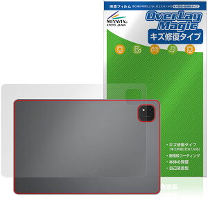 ALLDOCUBE iPlay 70 Pad Pro �w�� �ی�t�B���� OverLay Magic for �I�[���h�L���[�u �A�C�v���C �{�̕ی� ���C�� �w��h�~ �R�[�e�B���O