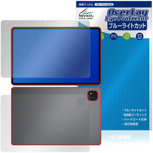 ALLDOCUBE iPlay 70 Pad Pro �\�� �w�� �ی�t�B���� OverLay Eye Protector for �I�[���h�L���[�u �A�C�v���C �u���[���C�g�J�b�g