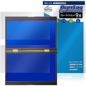�A�C�E�I�[�E�f�[�^ 14�^�f���A�����o�C���f�B�X�v���C LCD-YC1412DX �V���[�Y �ی�t�B���� OverLay Eye Protector 9H ���d�x �ڂɗD����