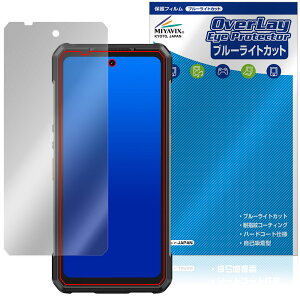 Ulefone Armor 34 Pro / Armor 34 Pro�{ �ی�t�B���� OverLay Eye Protector for �E���t�H�� �A�[�}�[ �v�� �t���ی� �u���[���C�g�J�b�g