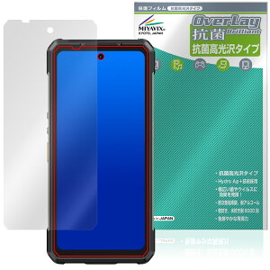Ulefone Armor 34 Pro / Armor 34 Pro�{ �ی�t�B���� OverLay �R�� Brilliant for �E���t�H�� �A�[�}�[ �v�� �R�E�C���X ������