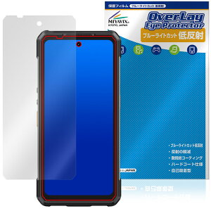 Ulefone Armor 34 Pro / Armor 34 Pro�{ �ی�t�B���� OverLay Eye Protector �ᔽ�� for �E���t�H�� �A�[�}�[ �v�� �u���[���C�g�J�b�g