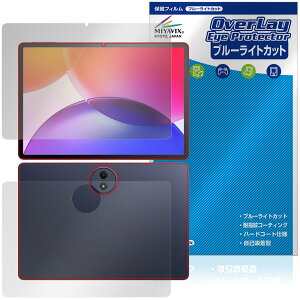 TCL TAB A1 Plus 9445X �\�� �w�� �ی�t�B���� OverLay Eye Protector for �e�B�[�V�[�G�� �^�u���b�g �ڂɗD���� �u���[���C�g�J�b�g
