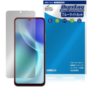 FOSSiBOT S5 Pro / S5 �ی�t�B���� OverLay Eye Protector for �X�}�[�g�t�H�� �t���ی� �ڂɗD���� �u���[���C�g�J�b�g