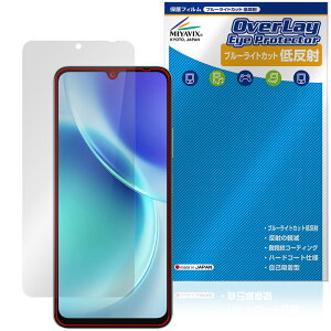 FOSSiBOT S5 Pro / S5 �ی�t�B���� OverLay Eye Protector �ᔽ�� for �X�}�[�g�t�H�� �t���ی� �u���[���C�g�J�b�g ���˖h�~