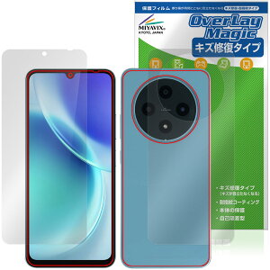 FOSSiBOT S5 Pro / S5 �\�� �w�� �ی�t�B���� OverLay Magic for �X�}�[�g�t�H�� ���C�� �ώw�� �w��h�~ �R�[�e�B���O