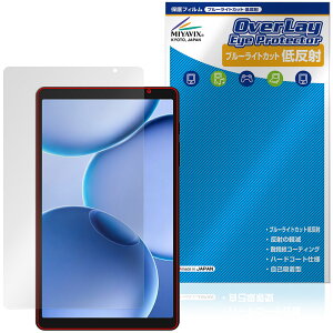 PHILIPS T7335 �ی�t�B���� OverLay Eye Protector �ᔽ�� for �t�B���b�v�X �^�u���b�g �t���ی� �u���[���C�g�J�b�g ���˖h�~