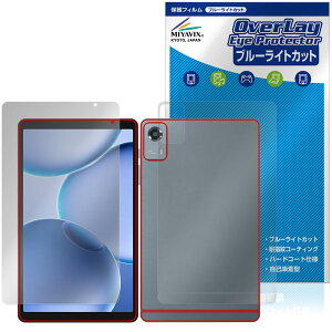 PHILIPS T7335 �\�� �w�� �ی�t�B���� OverLay Eye Protector for �t�B���b�v�X �^�u���b�g �ڂɗD���� �u���[���C�g�J�b�g