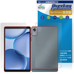 PHILIPS T7335 �\�� �w�� �ی�t�B���� OverLay Eye Protector �ᔽ�� for �t�B���b�v�X �^�u���b�g �u���[���C�g�J�b�g ���˖h�~