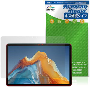 ALLDOCUBE iPlay 70E 2026 T1161 �ی�t�B���� OverLay Magic for �I�[���h�L���[�u �A�C�v���C ���C�� �ώw�� �w��h�~ �R�[�e�B���O