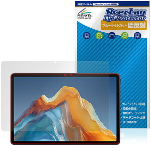 ALLDOCUBE iPlay 70E 2026 T1161 �ی�t�B���� OverLay Eye Protector �ᔽ�� for �I�[���h�L���[�u �A�C�v���C �u���[���C�g�J�b�g