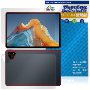 ALLDOCUBE iPlay 70E 2026 T1161 �\�� �w�� �ی�t�B���� OverLay Eye Protector �ᔽ�� for �I�[���h�L���[�u �A�C�v���C �ڂɗD����