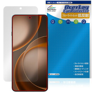 OPPO Find X9 Ultra �ی�t�B���� OverLay Eye Protector �ᔽ�� for �I�b�| �t�@�C���h X �t���ی� �u���[���C�g�J�b�g ���˖h�~