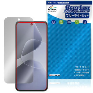 Infinix HOT 60 Pro �ی�t�B���� OverLay Eye Protector for �X�}�[�g�t�H�� �t���ی� �ڂɗD���� �u���[���C�g�J�b�g