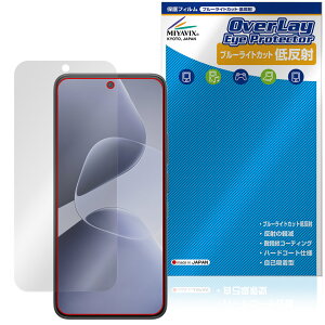 Infinix HOT 60 Pro �ی�t�B���� OverLay Eye Protector �ᔽ�� for �X�}�[�g�t�H�� �t���ی� �u���[���C�g�J�b�g ���˖h�~