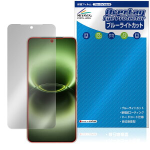 vivo X300 Ultra �ی�t�B���� OverLay Eye Protector for ���B�[���H �X�}�[�g�t�H�� �G�b�N�X �t���ی� �ڂɗD���� �u���[���C�g�J�b�g