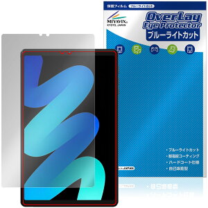 PHILIPS T7250 �ی�t�B���� OverLay Eye Protector for �t�B���b�v�X �^�u���b�g �t���ی� �ڂɗD���� �u���[���C�g�J�b�g