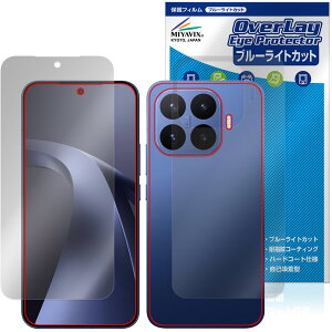 �y�\�񏤕i�F6��4�����o�׊J�n�\��zXiaomi 17T Pro �\�� �w�� �ی�t�B���� OverLay Eye Protector for �V���I�~�[ �X�}�[�g�t�H�� �ڂɗD���� �u���[���C�g�J�b�g