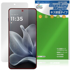 motorola moto X70 Air �ی�t�B���� OverLay Magic for ���g���[�� ���g �G�b�N�X �t���ی� ���C�� �ώw�� �w��h�~ �R�[�e�B���O