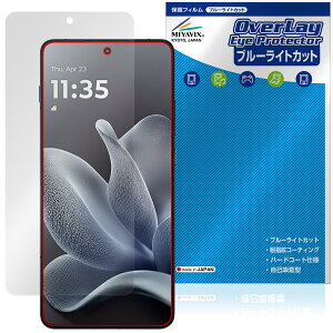 motorola moto X70 Air �ی�t�B���� OverLay Eye Protector for ���g���[�� ���g �G�b�N�X �t���ی� �ڂɗD���� �u���[���C�g�J�b�g