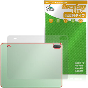 OnePlus Pad 4 �w�� �ی�t�B���� OverLay Plus �����v���X �p�b�h �^�u���b�g �{�̕ی� �t�B���� ���炳���G�� �ᔽ�ˑf��