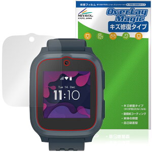 myFirst Fone S3 / S3�{ / S3c �ی�t�B���� OverLay Magic for �}�C�t�@�[�X�g�t�H�� �G�X �t���ی� ���C�� �ώw�� �w��h�~