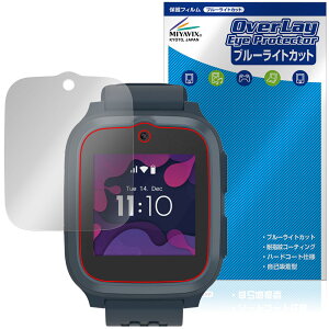 myFirst Fone S3 / S3�{ / S3c �ی�t�B���� OverLay Eye Protector for �}�C�t�@�[�X�g�t�H�� �G�X �t���ی� �u���[���C�g�J�b�g