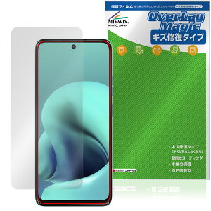 motorola moto g37 / g37j �C���J�������Ȃ� �ی�t�B���� OverLay Magic for ���g���[�� ���g �W�[ �t���ی� ���C�� �ώw�� �w��h�~