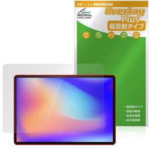 KHADAS Mind xPlay �ی�t�B���� OverLay Plus for ���o�C�����j�^�[ �t���ی� �A���`�O���A ���˖h�~ ����� �w��h�~