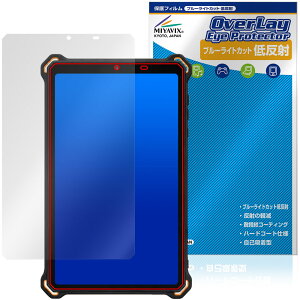 AGM PAD P3 Compact �ی�t�B���� OverLay Eye Protector �ᔽ�� for �^�t�l�X �^�u���b�g �t���ی� �u���[���C�g�J�b�g ���˖h�~