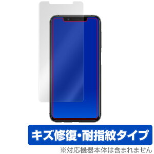 Mayumi U1 �ی�t�B���� OverLay Magic for Mayumi U1 �\�ʗp�ی�V�[�g �t�� �ی� �L�Y�C�� �ώw�� �h�w�� �R�[�e�B���O �X�}�z�t�B���� �������� �~���r�b�N�X