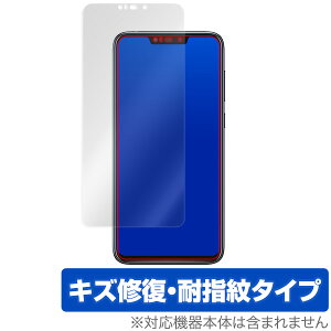 ASUS ZenFone Max (M2) ZB633KL یtB OverLay Magic for ASUS ZenFone Max (M2) ZB633KL \ʗpیV[g t ی LYC ώw hw R[eBO X}ztB  ~rbNX