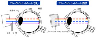 LGgram17インチ17Z990用保護フィルムOverLayEyeProtectorforLGgram17インチ17Z990液晶保護目にやさしいブルーライトカット