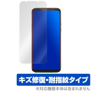 Black Shark2 یtB OverLay Magic for Black Shark2 SKW-A0 / SKW-H0 LYC ώw hw R[eBO Xiaomi VI~ ubNV[Nc[ X}ztB  ~rbNX