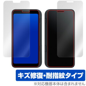 LGV50 Thin Q 5G یtB OverLay Magic for LG V50 ThinQ 5G fAfBXvCJo[p \ʁEwʃZbg LYC ώw hw R[eBO X}ztB  ~rbNX